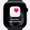 Tính năng tăng huyết áp trên Apple Watch Series 11 gây lo ngại về độ chính xác trong cộng đồng người dùng