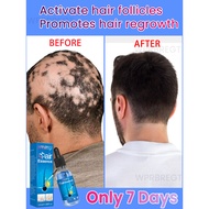 Hair growth essential oil helps grow hair and reduce hair loss. This all-natural formula revitalizes