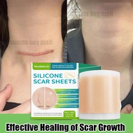 silicone scar sheet scar removal patch acne scar stretch mark keloid scar patch silicon scar tape Ol