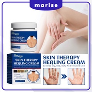 South Moon SKIN Therapy Healing SKIN ANTI-ITCH CREAM Most Powerful Itching Ointment Psoriasis CREAM