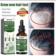 【in stock】Hair Growth Serum Hair Tonic Serum Minyak Lebatkan Rambut serum rambut gugur Pelebat rambu