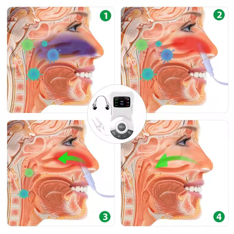 Nose Rhinitis Relief Treatment Machine Sinusitis Nose Cure Therapy Massage Device Cure Hay Fever Low