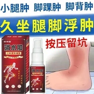 Reduce Edema Edema Edema Floating Elderly Body Reduce Edema Legs Foot Floating Edema Men Women Can U