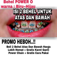 Bisa Heboh . Atas Dan Bawah Behel Lepas Pasang Murah Warna Hijau Biru