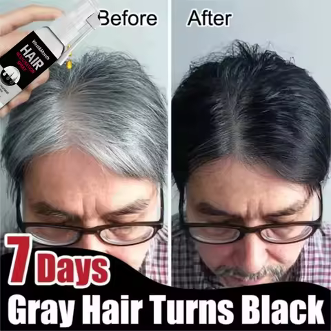 Gray White Hair Treatment Serum Cover White Hair To Black Natural Color Repair Spray Anti Loss Hair 