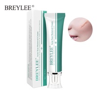 ❏  BREYLEE Acne Scar Removal Cream Skin Repair Care Scar Acne Treatment Lighten Stretch Marks Skin Regeneration Skincare Products