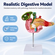 Medical Human Anatomy Model Pancreas Duodenum Spleen Gallbladder Pathology Teaching Aid with Liver P