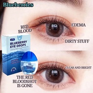 【PrettyFloral】Blueberry Eye Drops | Itchy Eyes | Glaucoma |Eye Drops |Dry Eyes |Eye Drops |Sore Eyes