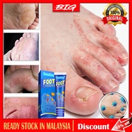 Ubat Kaki Berbau Fungus Cream Foot Treatment Ubat Gatal Kulit Ubat Kaki Makan Air Kaki Berbau Busuk 