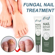 EELHOE Nail Repair Cream Antibacterial Nail Treatment Nail Fungus Paronychia Onychomycosis 20g