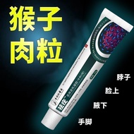 Lizhen Flat Warts Warts skin bulge Granular Meat Monkey plana verruca skin bulge Traditional Chinese