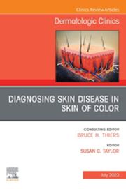 Diagnosing Skin Disease in Skin of Color, An Issue of Dermatologic Clinics, E-Book Susan C. Taylor, MD