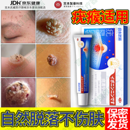 宫本武藏疣清宁扁平疣丝状疣尖锐湿疣跖疣专用非药疣体脱落去克疣膏灵肉粒瘊子搭咪喹奎莫特5%五氟尿嘧乳膏软