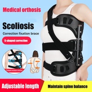 Adjustable Scoliosis Posture Corrector Spinal Auxiliary Orthosis Back Postoperative Recovery Adults