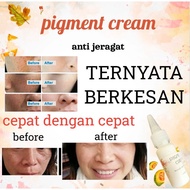 pigment CREAM.krim jeragat berkesan.krim hilang parut muka berkesan.krim sunburn berkesan