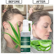 MINOXIDIL 5% penumbuh rambut & brewok with Aloe Vera for MEN made in USA - RAYGOLD - MINOX MINOKSIDI