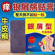 Psoriasis patch, tinea cruris, tinea pedis, eczema, tinea capitis, skin itch, rworm and itchin牛皮癣银屑病