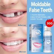 Temporary Tooth Repair Kit Dental Filling Teeth Gaps Moldable Falseteeth Solid Glue Denture Adhesive