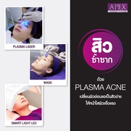 [E-Voucher] APEX Plasma acne เลเซอร์ช่วยลดการเกิดสิว ผลัดเซลล์ผิว ลดความมัน กระชับรูขุมขนฆ่าเชื้อสิว