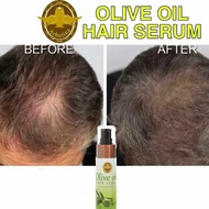 Arbutina Olive Oil Hair Growth &amp; Loss Serum Penumbuh Rambut Rontok