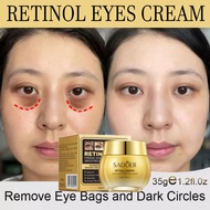 Retinol Eye Cream - Skincare Anti Aging Krim Mata Untuk Kerutan Di Bawah Mata - Retinol Anti-Aging R