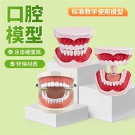 Dental Material/Dental Consumables Oral Model Dental Teaching Model Denture Model Dental Dental Mode