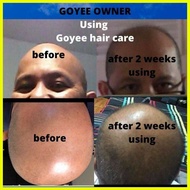 ♞,♘Goyee hair care shampoo and conditioner with glutamansi soap