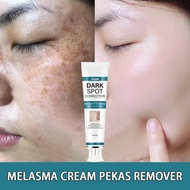 Facial Dark Spot Remover Cream | Melasma Treatment & Dark Spot Remover, Dark Spot Remover f