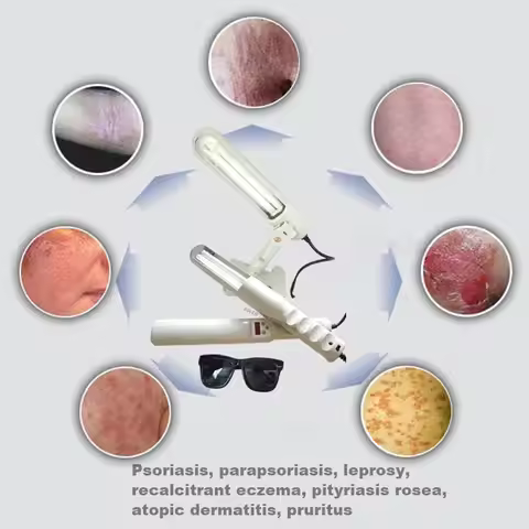 311NM UVB Phototherapy Lamp Device for Vitiligo Treatment UV NarrowBand Ultraviolet Light Therapy Ps