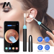MicroBang WiFi Ear Pick Intelligent Cleaner LED Flashlight Visible Ear Spoon Ear Wax Removal Ear Cleaner Visual Ear Scope Camera Safe Ear Pick Ear Cleaning Tool with HD Camera for iPhone, iPad &amp; Android Smart Phones