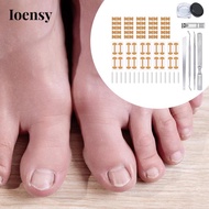 [Ioensy] Ingrown Toenail Correction Patch, Breathable Toenail Correction Stickers,