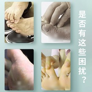 Foot Odor Foot Sweat Spray Itchy Foot Shoes Socks Deodorant Foot Spray Foot Odor Foot Sweat Spray 26