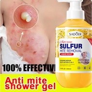 SADOER Anti-acne Shower Gel Anti-mite Sulfur Shower Relief Anti-acne Whitening Shower Gel Relieves i