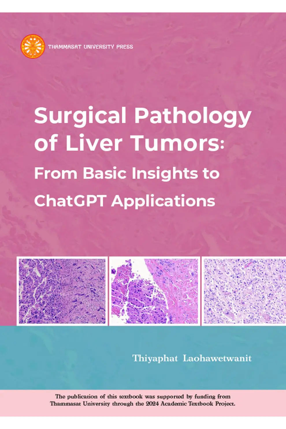 Surgical Pathology of Liver Tumors: From Basic Insights to ChatGPT Applications (PDF)