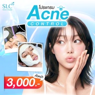 [E-Voucher] Slc Clinic - โปรแกรม Acne control (ทั่วหน้า)