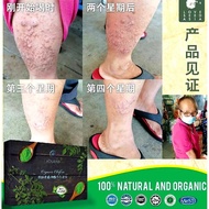 (30Packs @25ml) MORINGA OLEIFERA HOSANNA 100% ORGANIC Upgrade Moringa Elixir ATOMY 辣木皇