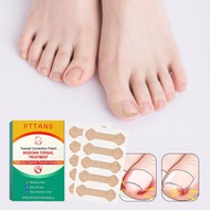 Ingrown Toenail Treatment, 60Pcs Breathable Ingrown Toenail Strips, Professional Painless Pedicure f