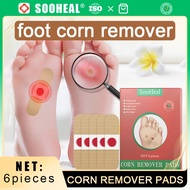 【SooHeal】Foot corn corn remover ellgy corn and warts 鸡眼贴NET;6pieces Painless natural shedding