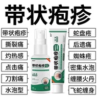 With Herpes Anti-Itch Cream Relieve Burning Fast Soothing Herpes Special Sprays Herpes Anti-Itch Cre