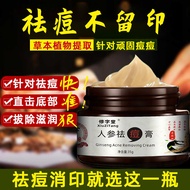 Chinese medicine ginseng removes acne cream to remove acne m#中药人参祛痘膏去痘印 医用草本精华祛痘膏去痘痘神器青春痘学生03031