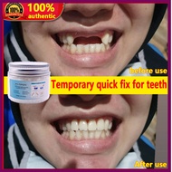 【Fifth store】DIY Tooth Repair Kit Temporary Teeth Restoration 50g Artificial temporary tooth teeth T