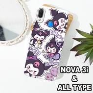 G7 - HUAWEI NOVA 3i Silicone - HUAWEI NOVA 3i pro camera Softcase - GIRL'S Motif - Flexible rubber m