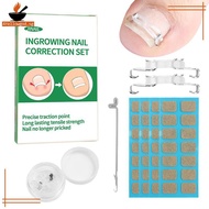AYellowgod 1/2 Set Ingrown Toenail Corrector Tools Pedicure Recover Embed Toenail Treatment Professi
