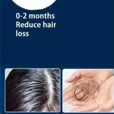 96 Laser Hair Growth Cap 650nm LLLT Red Light Therapy Cap Treatment Hat for Scalp Oil Control Hair L