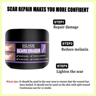 ⊜ ♟ ✢ EELHOE Original Scar Repair Cream for old scar stretch mark remover acne scar remover Aliver