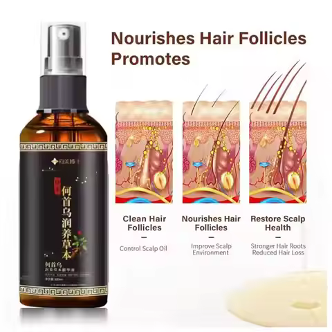 Hair Loss Solution Hair Growth Serum Spray For Men And Women,Hair Serum Polygonum Multiflori Radix, 