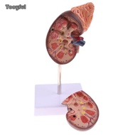 Tooyful 1:1 Human Removable 2 Parts Kidney With Adrenal Gland Anatomical Model School Teaching Displ