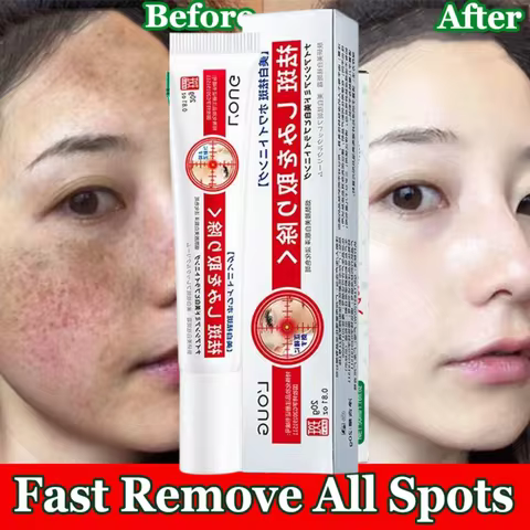 Whitening Freckle Cream Moisturizing Brightening Anti-freckle Lighten Reduce Dark Skin For Face Care