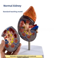 Magnified Human Kidney Model with Adrenal Gland Pathological Kidney & Glomerulus Anatomy Teaching Ai
