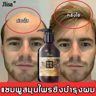 ZHENXIU 300ml แชมพูแก้ผมร่วง แชมพูขิง แชมพูสำหรับผมขาดหลุดร่วง ป้องกันผมร่วงบำรุงผม สูตรสมุนไพร แชมพูปลูกผม แชมพูเร่งผมยาว บำรุงรากผม แชมพูสมุนไพร ยาสระผมแก้ร่วง แชมพูสระผม รากผมแข็งแรง ซ่อมแซมผมเสีย Ginger Hair Shampoo